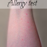 Allergy test